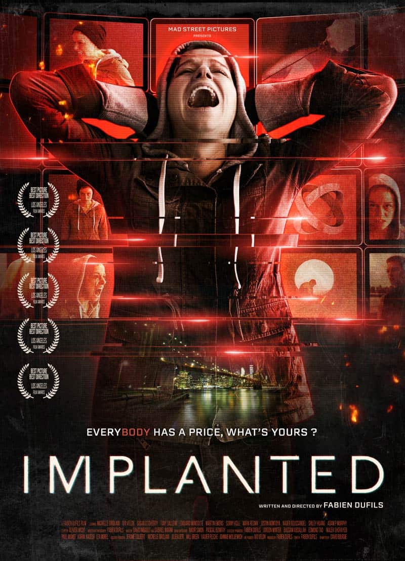 Implanted